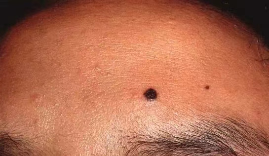 思茅区人民医院