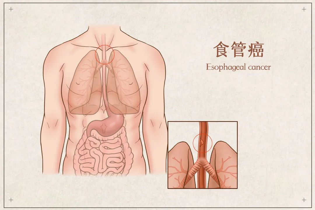 云南疾控
