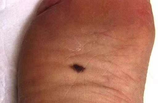 思茅区人民医院