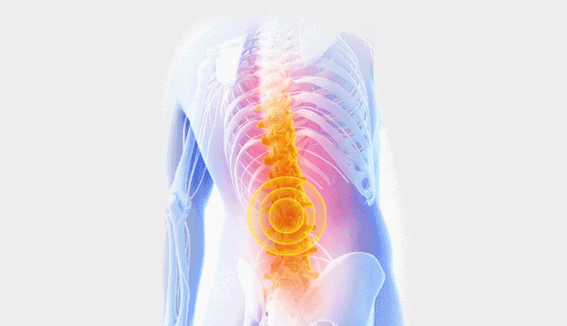 闪腰出现4种情况需要赶快就医