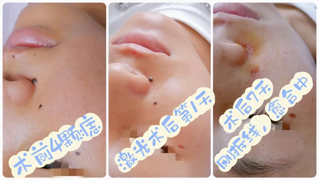 思茅区人民医院