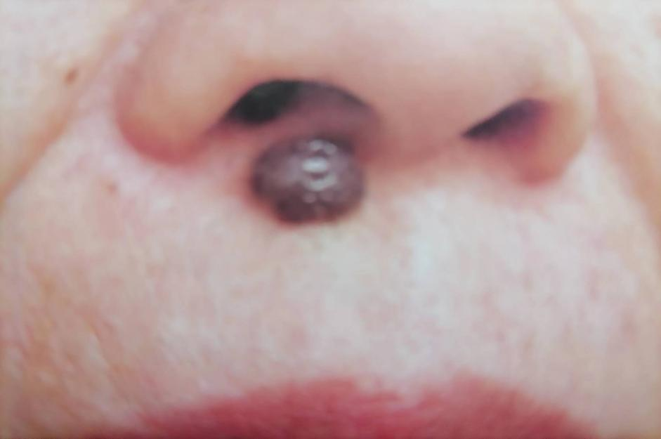 思茅区人民医院