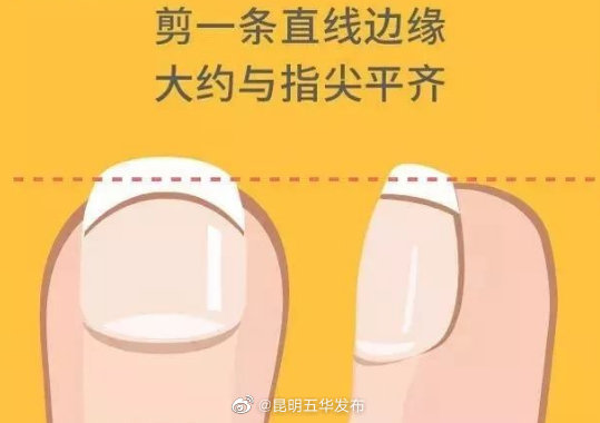 剪指甲要留出一小条白边