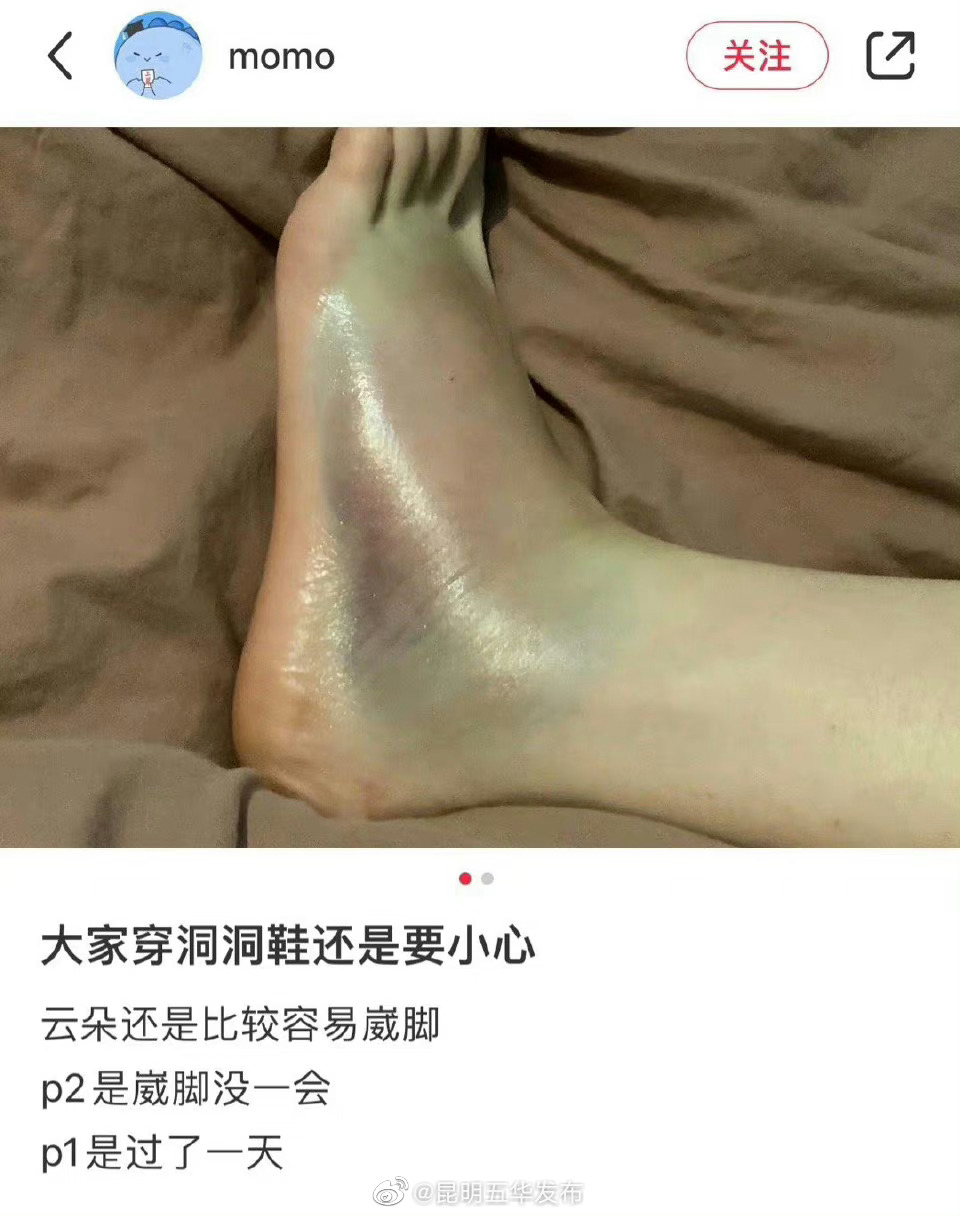 穿洞洞鞋千万要小心