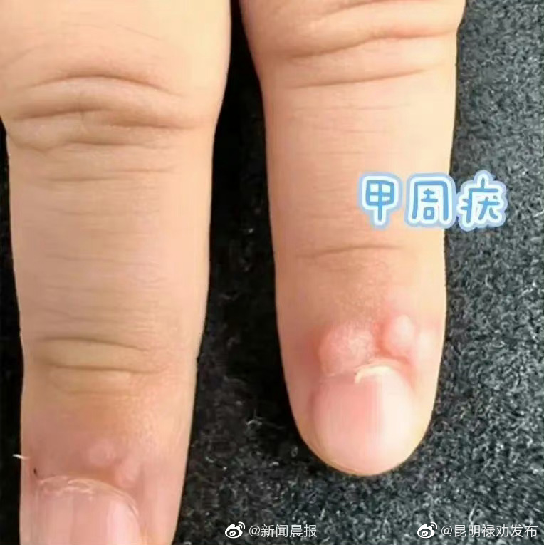 昆明禄劝发布
