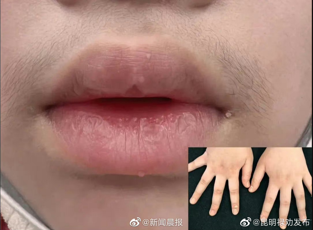昆明禄劝发布