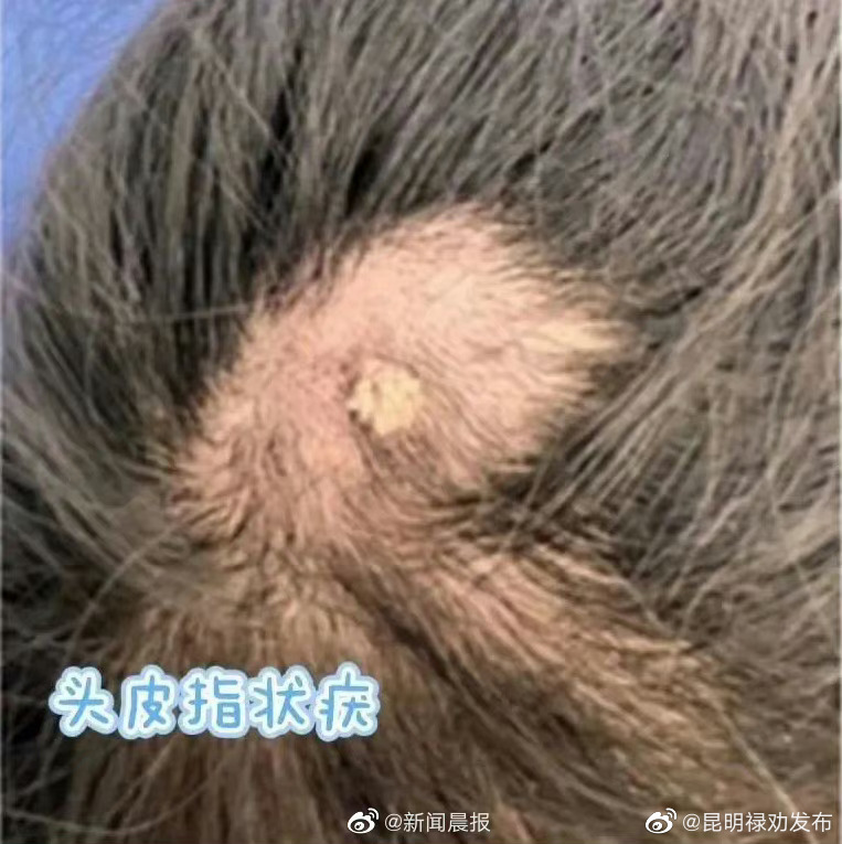 昆明禄劝发布