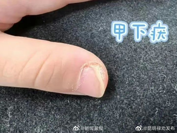 昆明禄劝发布