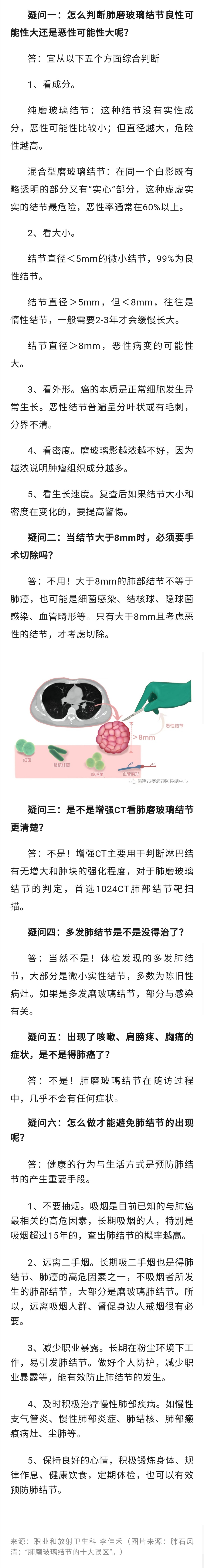 肺部CT查出“肺磨玻璃结节”，真的患肺癌了吗？