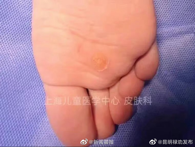 昆明禄劝发布