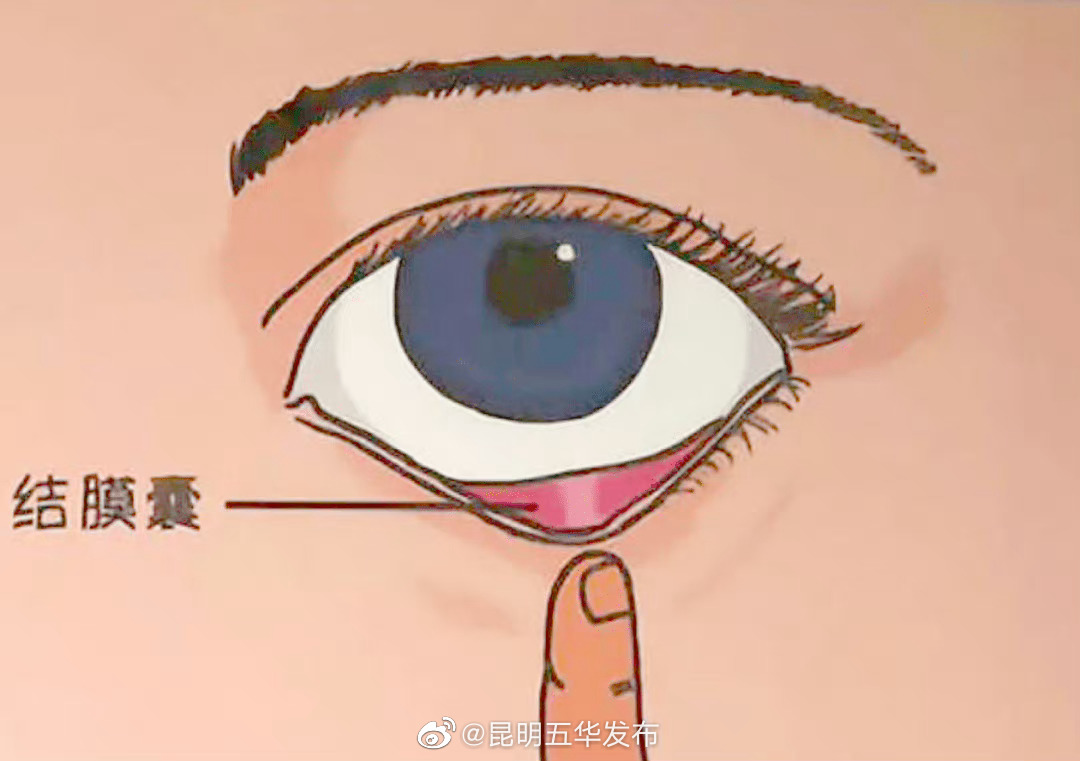 掉进眼里的睫毛都去哪里了