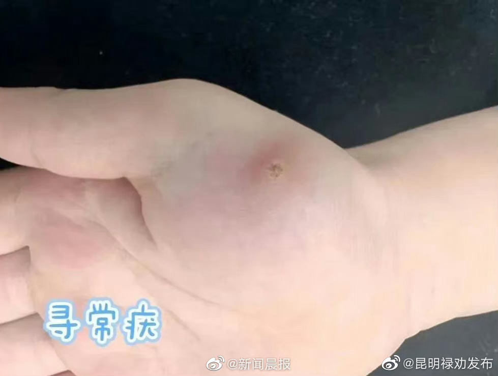 昆明禄劝发布