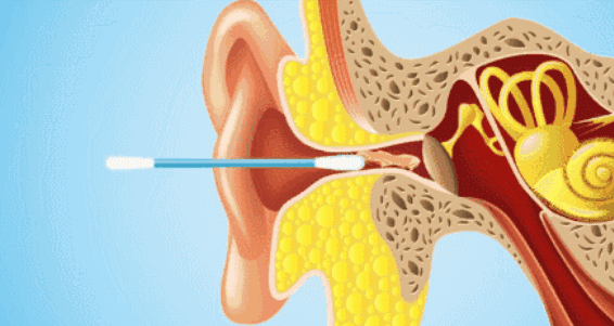 如何科学给耳朵止痒