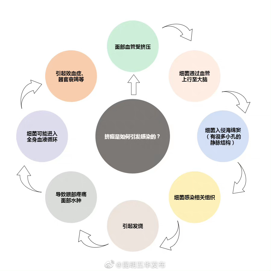 不同部位长痘的真正原因