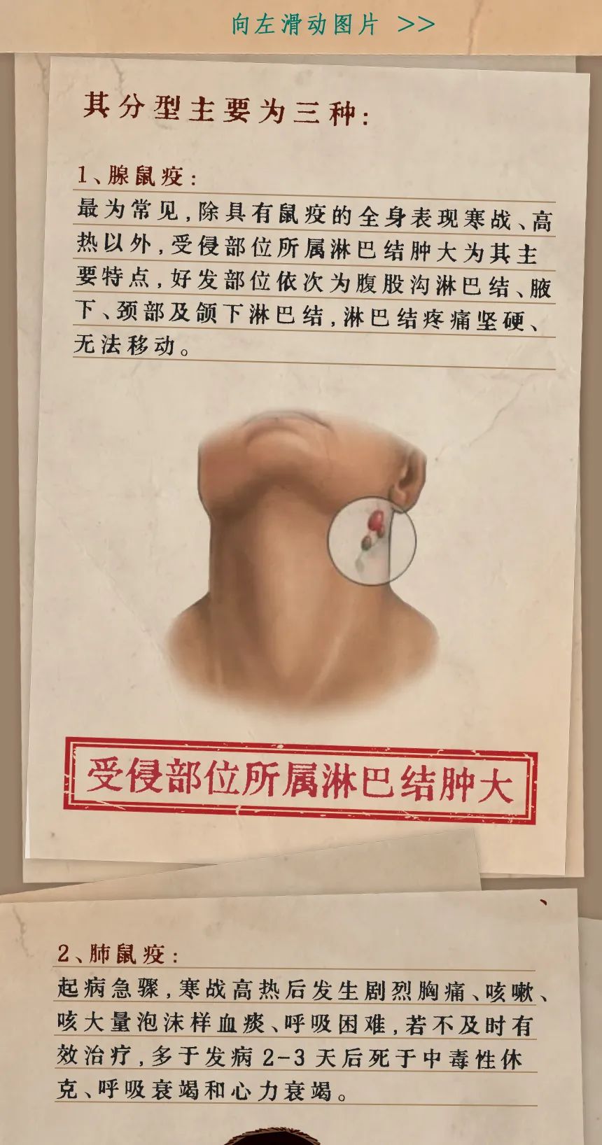 云南疾控