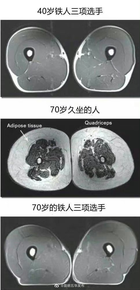 大腿粗的人心脏更强壮