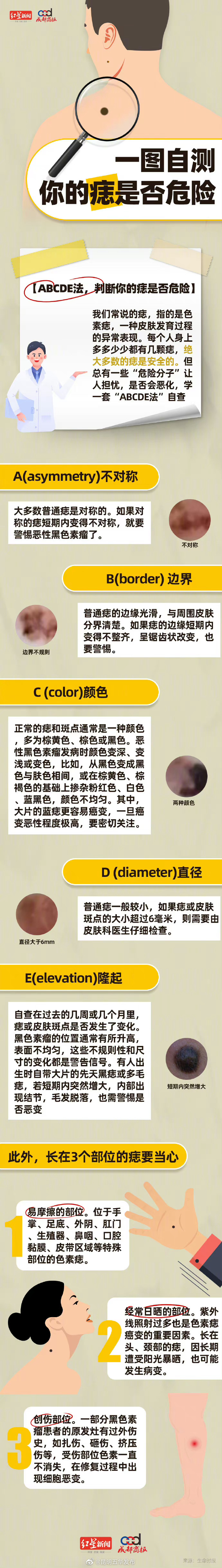 一图自测判断你的痣是否危险