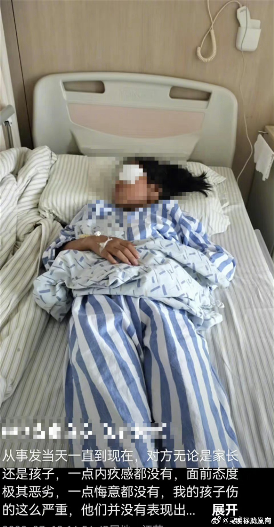 两少年用弹弓射瞎女童左眼，警方不予立案，伤者家属：不认可轻伤二级鉴定