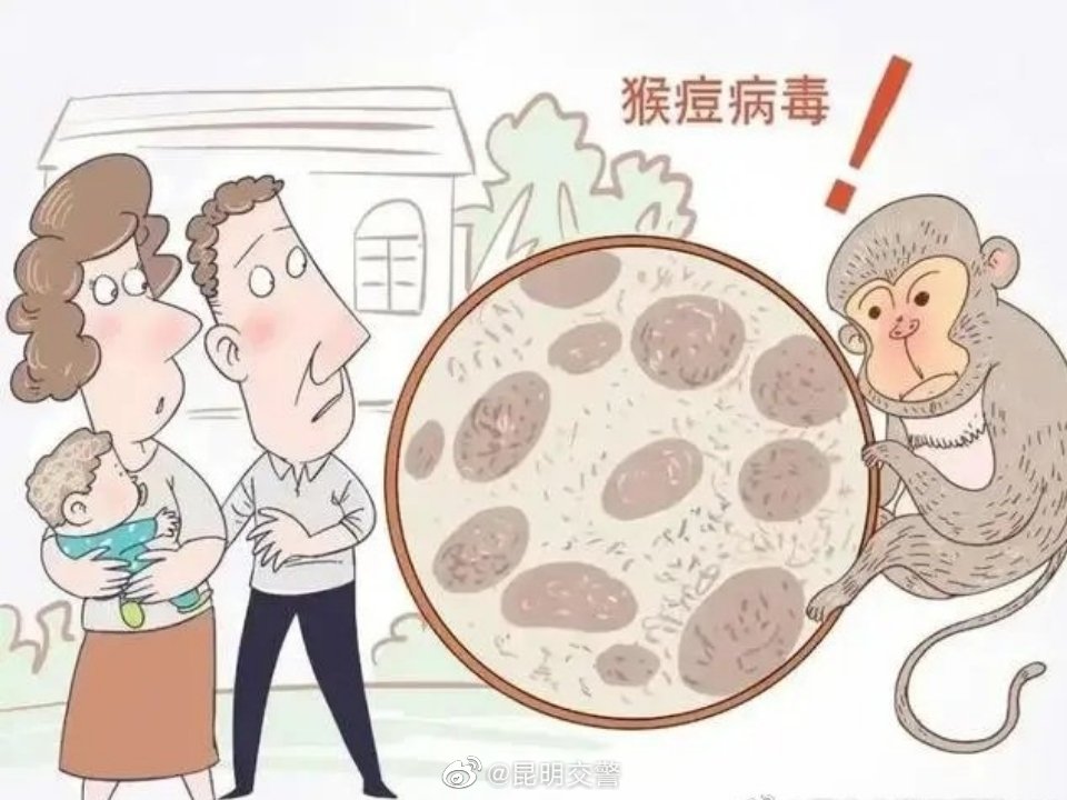 如何避免感染猴痘病毒?
