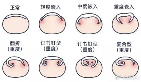 呈贡发布
