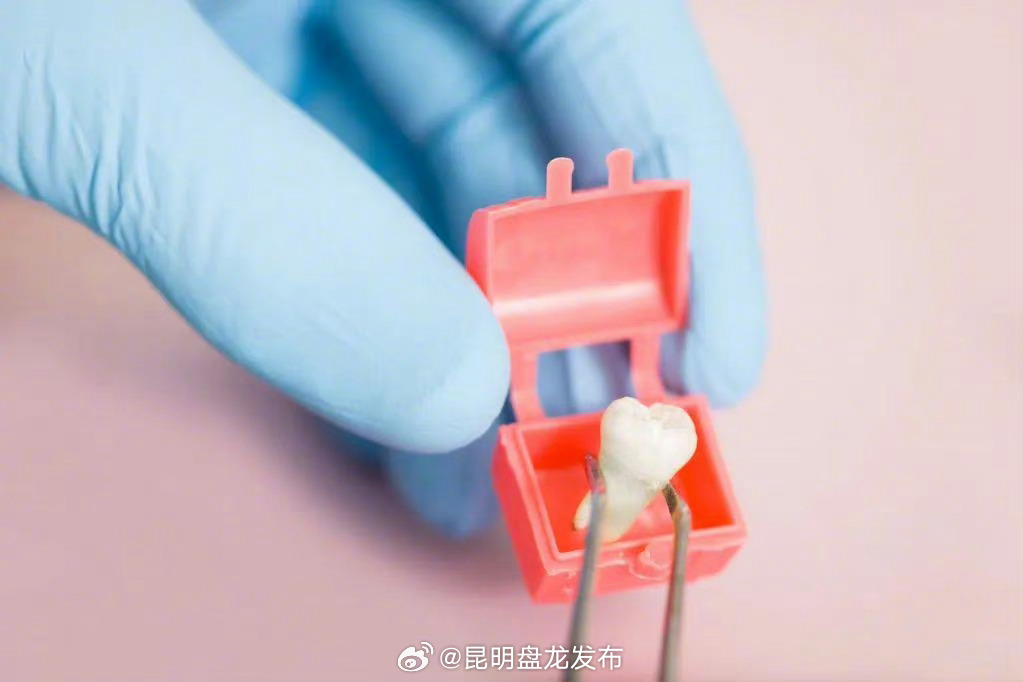 拔牙后2小时内别进食 