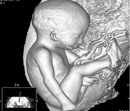 曲靖市妇幼保健院