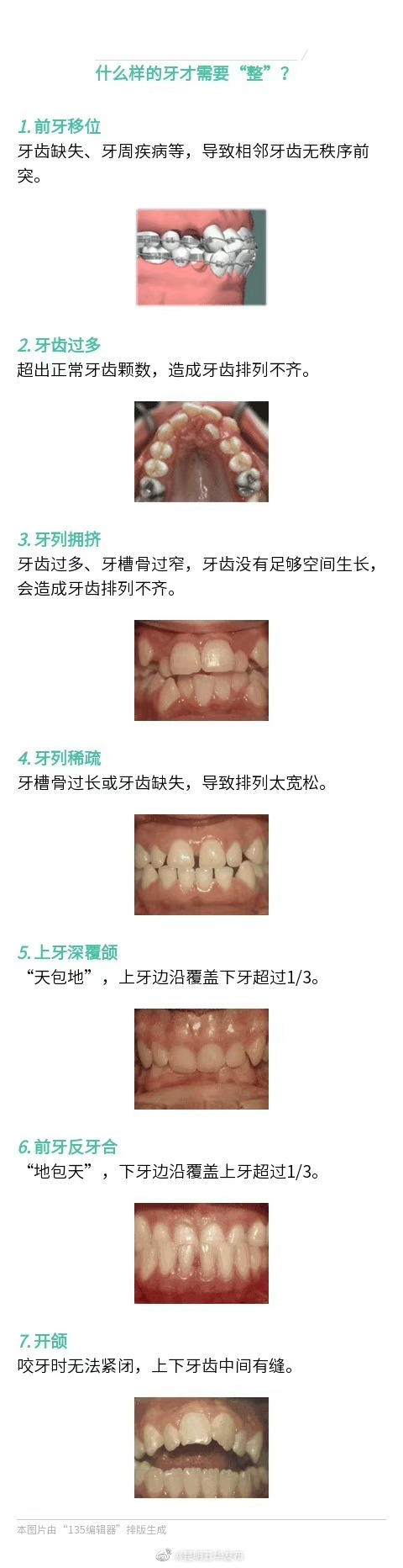 什么样的牙齿需要正畸