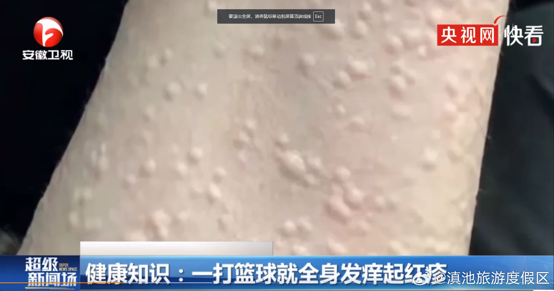 滇池旅游度假区