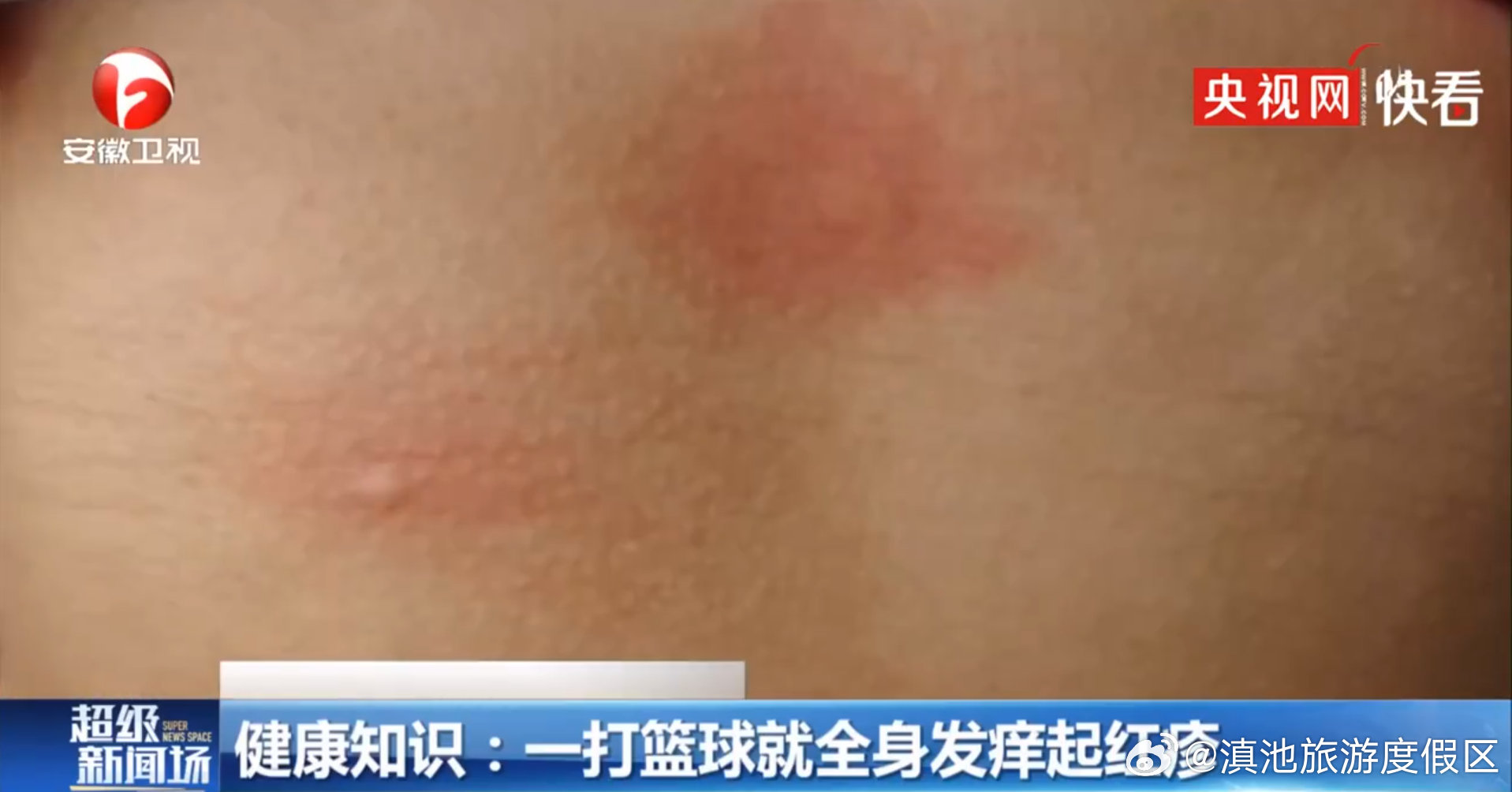 滇池旅游度假区