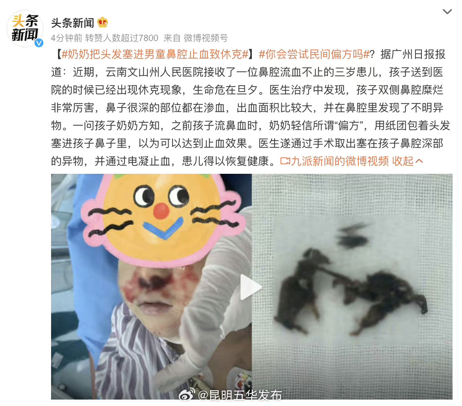 错误急救可能造成二次伤害 