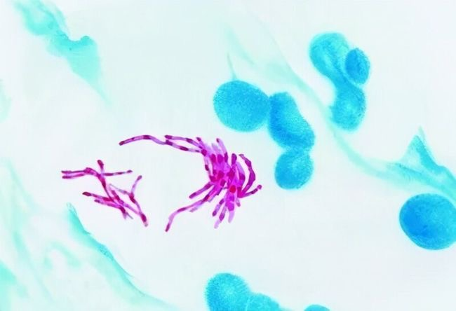 云南省文山州人民医院