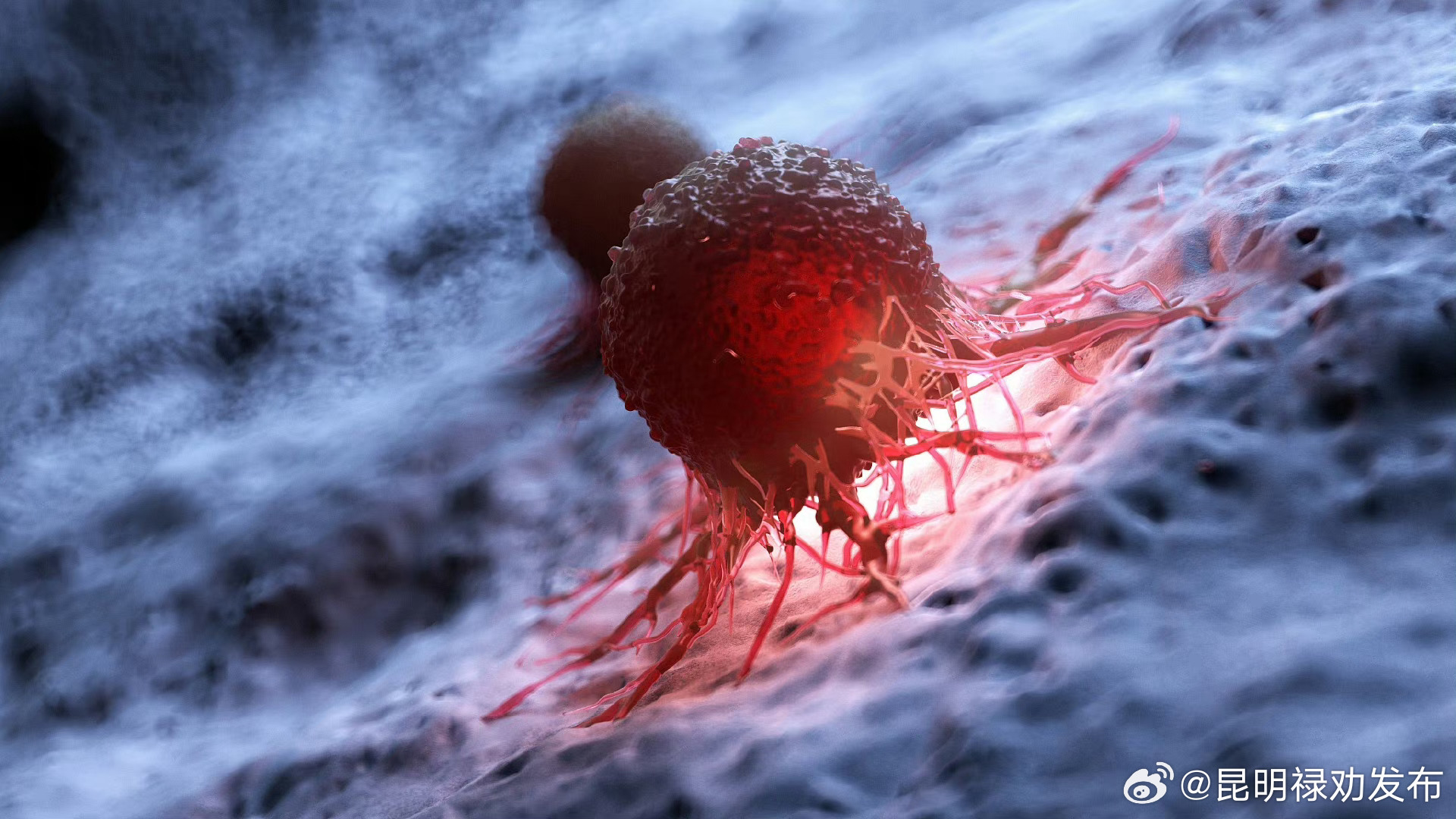 首次人体试验表明一种单克隆抗体可减缓肿瘤生长