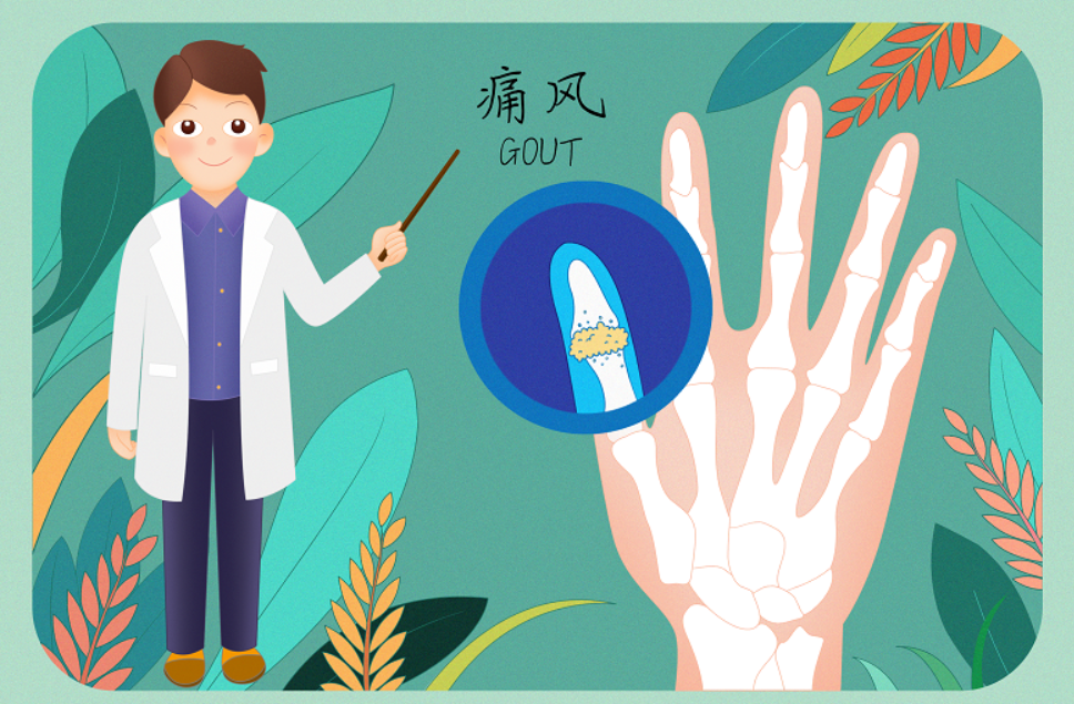 【健康科普】关于痛风，这些误区不该有