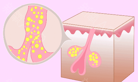 如何拥有健康的头皮环境