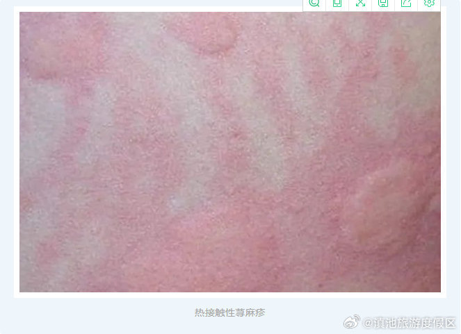 滇池旅游度假区