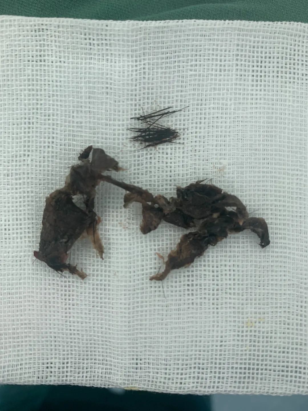 云南省文山州人民医院