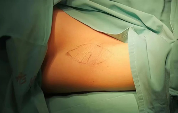 昆明市第一人民医院