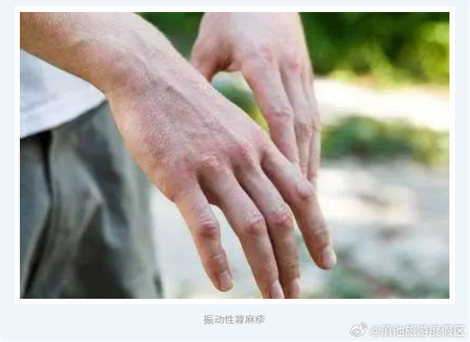 滇池旅游度假区