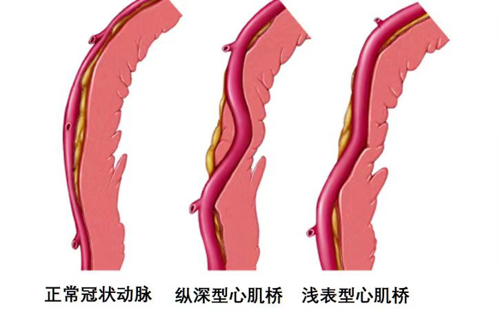 健康腾冲