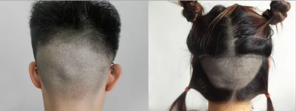 昆明市第一人民医院