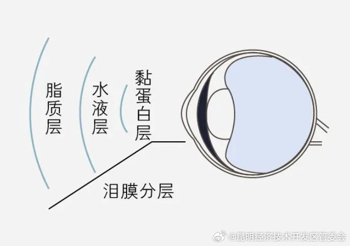 得了干眼症眼睛反而会变湿润