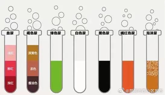 体检时为何要留晨尿