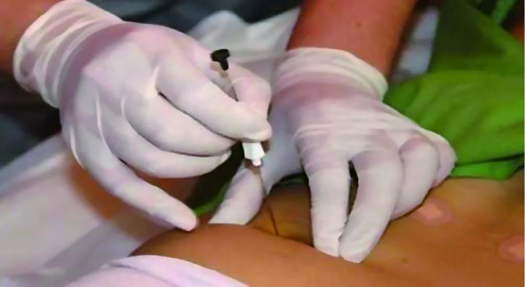 普洱市人民医院