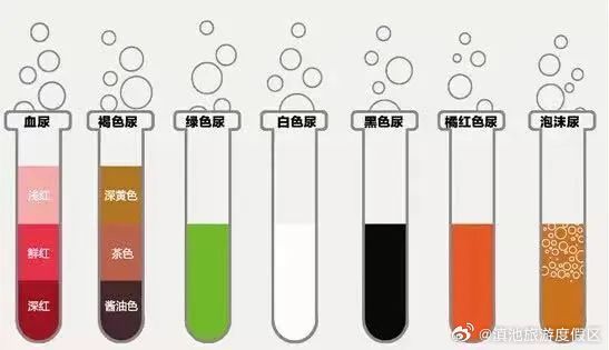 体检时为何要留晨尿