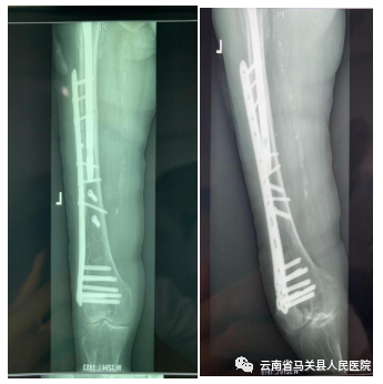 云南省马关县人民医院