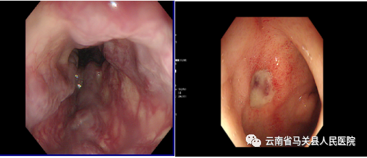 云南省马关县人民医院
