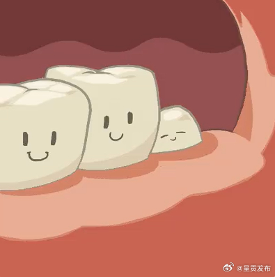 6种智齿建议拔除