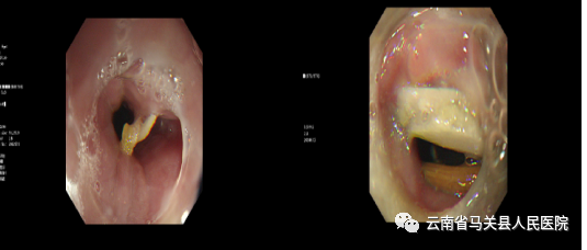 云南省马关县人民医院