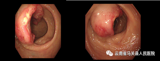 云南省马关县人民医院