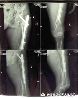 云南省马关县人民医院